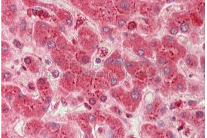 Rabbit Anti-SHB antibody Catalog Number: ARP58762 Formalin Fixed Paraffin Embedded Tissue: Human Adult Liver  Observed Staining: Cytoplasm in hepatocytes Primary Antibody Concentration: 1:600 Secondary Antibody: Donkey anti-Rabbit-Cy3 Secondary Antibody Concentration: 1:200 Magnification: 20X Exposure Time: 0.