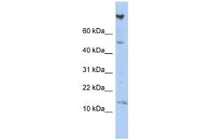 NRARP antibody used at 1 ug/ml to detect target protein. (NRARP anticorps  (Middle Region))