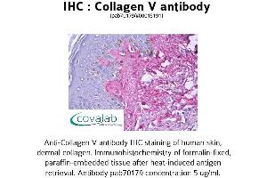 Image no. 1 for anti-Collagen, Type V (COL5) antibody (ABIN1733224) (Collagen Type V anticorps)
