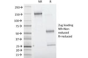 SDS-PAGE Analysis Purified Villin Monoclonal Antibody (VIL1/1314).