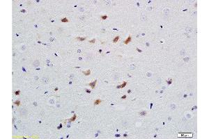 Formalin-fixed and paraffin embedded rat brain labeled with Anti PHAP1 Polyclonal Antibody, Unconjugated  at 1:200 followed by conjugation to the secondary antibody and DAB staining