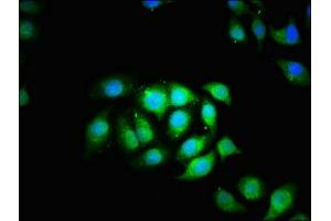 Immunofluorescence staining of A549 cells with ABIN7171419 at 1:166, counter-stained with DAPI.
