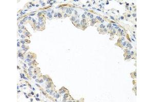 Immunohistochemistry of paraffin-embedded Mouse lung using IL22 Polyclonal Antibody at dilution of 1:100 (40x lens). (IL-22 anticorps)