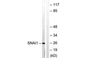 Western blot analysis of extracts from HT29 cells, using SNAI1 (Ab-246) Antibody.