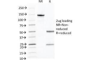 SDS-PAGE Analysis of Purified, BSA-Free Keratin 10 Antibody (clone KRT10/844).