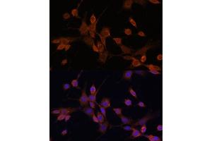 Immunofluorescence analysis of NIH/3T3 cells using MEK3 antibody (ABIN6130544, ABIN6143484, ABIN6143485 and ABIN6223650) at dilution of 1:100.