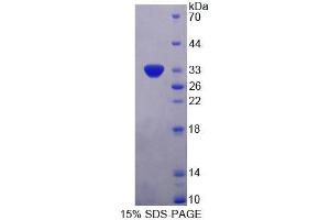 SDS-PAGE (SDS) image for Perilipin 4 (PLIN4) (AA 349-656) protein (His tag) (ABIN3209949)