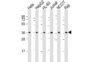 Western Blot at 1:2000 dilution Lane 1: Hela whole cell lysate Lane 2: HepG2 whole cell lysate Lane 3: HL-60 whole cell lysate Lane 4: Jurkat whole cell lysate Lane 5: NCCIT whole cell lysate Lane 6: Raji whole cell lysate Lysates/proteins at 20 ug per lane. (OGG1 anticorps  (C-Term))