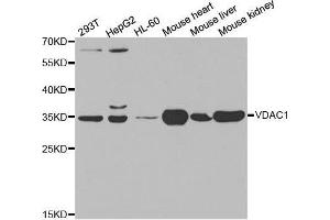 Western blot analysis of extracts of various cell lines, using VDAC1 antibody. (VDAC1 anticorps  (AA 1-283))