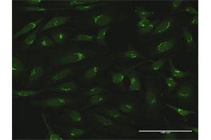 Immunofluorescence of purified MaxPab antibody to GOLGA5 on HeLa cell.