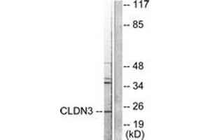 Western blot analysis of extracts from HuvEc cells, using Claudin 3 Antibody. (Claudin 3 anticorps  (AA 171-220))