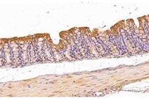 Immunohistochemistry analysis of paraffin-embedded mouse colon using,KIF5B (ABIN7074440) at dilution of 1: 1000 (KIF5B anticorps)