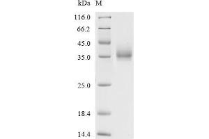 (Tris-Glycine gel) Discontinuous SDS-PAGE (reduced) with 5 % enrichment gel and 15 % separation gel.