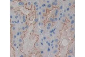 Figure. (MCAM anticorps  (AA 324-565))