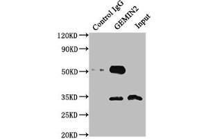 Immunoprecipitating GEMIN2 in 293T whole cell lysate Lane 1: Rabbit control IgG instead of ABIN7153753 in 293T whole cell lysate. (SIP1 anticorps  (AA 1-280))
