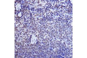 Immunohistochemistry of paraffin-embedded mouse spleen using POLR2A Rabbit pAb (ABIN6130298, ABIN6145914, ABIN6145915 and ABIN6215095) at dilution of 1:50 (40x lens). (POLR2A/RPB1 anticorps  (AA 1-260))