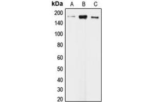 Western blot analysis of CLIP1 expression in KNRK (A), HeLa (B), HepG2 (C) whole cell lysates. (CLIP1 anticorps  (C-Term))
