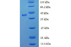 SDS-PAGE (SDS) image for Filaggrin (FLG) (AA 3838-4061), (partial) protein (His-SUMO Tag) (ABIN5709531)