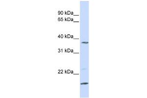 WB Suggested Anti-ZDHHC19 Antibody Titration:  0. (ZDHHC19 anticorps  (N-Term))