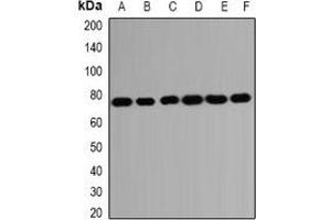 Western blot analysis of HSPA2 expression in SKOV3 (A), Hela (B), A431 (C), mouse brain (D), mouse testis (E), rat kidney (F) whole cell lysates. (HSPA2 anticorps)