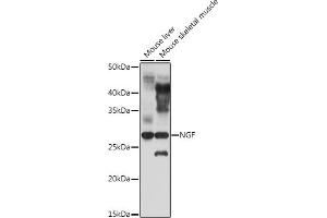 Western blot analysis of extracts of various cell lines, using NGF antibody (ABIN3020811, ABIN3020812, ABIN3020813 and ABIN6213735) at 1:1000 dilution. (Nerve Growth Factor anticorps  (AA 19-241))