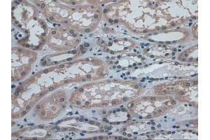 IHC-P analysis of Human Kidney Tissue, with DAB staining. (IDE anticorps  (AA 753-973))