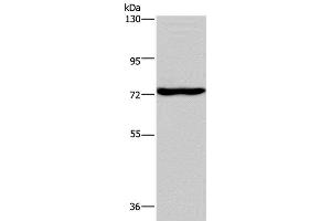 Western Blot analysis of Mouse brain tissue using KCND1 Polyclonal Antibody at dilution of 1:400