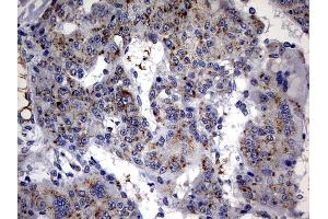 Immunohistochemistry (IHC) image for anti-ATP-Binding Cassette, Sub-Family D (Ald), Member 1 (ABCD1) (AA 508-745) antibody (ABIN2715622) (ABCD1 anticorps  (AA 508-745))