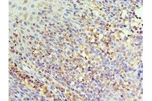 Immunohistochemistry of paraffin-embedded human tonsil tissue using ABIN7156854 at dilution of 1:100 (IL22 Receptor alpha 1 anticorps  (AA 16-230))