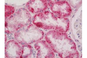 Human Kidney: Formalin-Fixed, Paraffin-Embedded (FFPE).