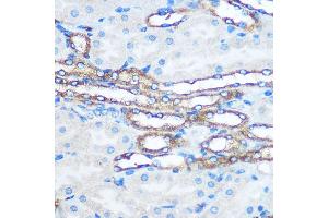 Immunohistochemistry of paraffin-embedded Mouse kidney using PKM2 Rabbit pAb (ABIN6128296, ABIN6145714, ABIN6145715 and ABIN6218076) at dilution of 1:100 (40x lens). (PKM anticorps  (AA 11-221))