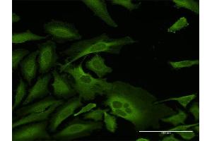 Immunofluorescence of purified MaxPab antibody to CAP1 on HeLa cell. (CAP1 anticorps  (AA 1-475))