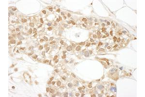Immunohistochemistry (IHC) image for anti-Megakaryoblastic Leukemia (Translocation) 1 (MKL1) (AA 700-750) antibody (ABIN7453732)
