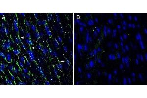 Expression of TMEM66 in mouse heart - Immunohistochemical staining of frozen mouse heart sections with Anti-TMEM66 Antibody (ABIN7043863, ABIN7044034 and ABIN7044035), (1:200), followed by goat anti-rabbit-AlexaFluor-488.
