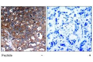 Image no. 1 for anti-Insulin-Like Growth Factor 1 Receptor (IGF1R) (Tyr1346) antibody (ABIN319345)