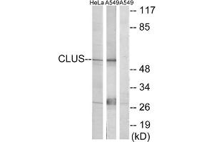Western blot analysis of extracts from HeLa cells and A549 cells, using CLUS antibody. (Clusterin anticorps  (C-Term))