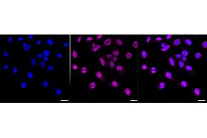 Immunocytochemical staining of HepG2 cells with Chromodomain helicase DNA binding protein 3 antibody (ABIN7798068), 1:1,000). (Recombinant CHD3 anticorps)