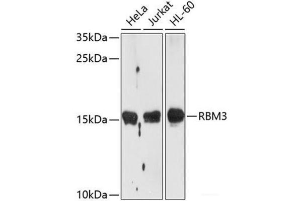 RBM3 anticorps