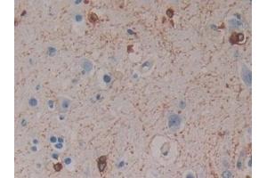 Detection of CRYaB in Human Cerebrum Tissue using Polyclonal Antibody to Crystallin Alpha B (CRYaB)