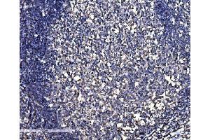 IHC analysis of SNAP23 using anti-SNAP23 antibody (ABIN7603236). (SNAP23 anticorps  (N-Term))