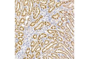 Immunohistochemistry of paraffin-embedded mouse kidney using UQCRH Rabbit mAb (ABIN7271126) at dilution of 1:50 (40x lens). (UQCRH anticorps)