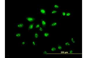 Immunofluorescence of monoclonal antibody to ZNF136 on HeLa cell. (ZNF136 anticorps  (AA 444-540))