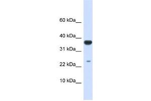 WB Suggested Anti-UBE2D2 Antibody Titration:  0. (UBE2D2 anticorps  (Middle Region))