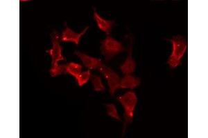 ABIN6275676 staining HeLa by IF/ICC. (CACNG1 anticorps  (Internal Region))