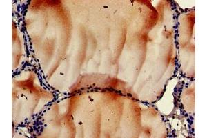 Immunohistochemistry of paraffin-embedded human thyroid tissue using ABIN7168188 at dilution of 1:100