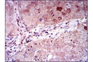 Immunohistochemistry (IHC) image for anti-Enolase 2 (Gamma, Neuronal) (ENO2) (AA 251-433) antibody (ABIN1846262) (ENO2/NSE anticorps  (AA 251-433))