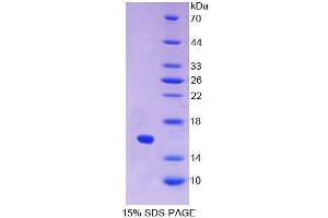 SDS-PAGE (SDS) image for Interferon alpha (IFNA) (AA 24-133) protein (His tag) (ABIN6236533)