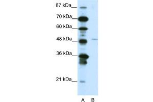 WB Suggested Anti-MEOX2 Antibody Titration:  1. (MEOX2 anticorps  (N-Term))