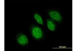 Immunofluorescence of purified MaxPab antibody to RBBP9 on HeLa cell. (RBBP9 anticorps  (AA 1-186))