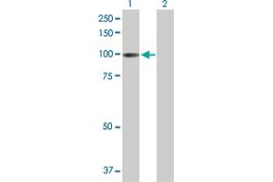 Western Blot analysis of ITIH1 expression in transfected 293T cell line by ITIH1 MaxPab polyclonal antibody. (ITIH1 anticorps  (AA 1-911))